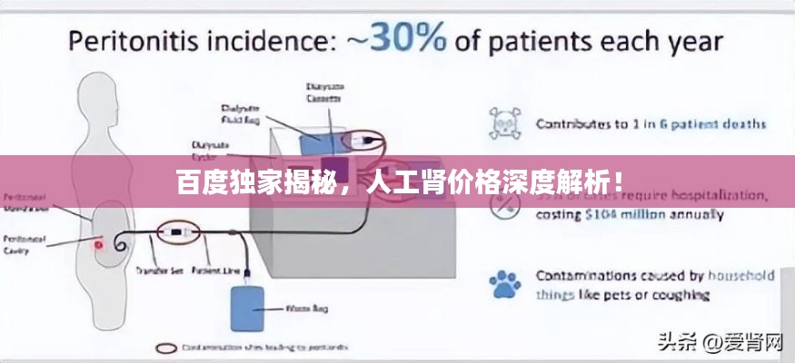 百度独家揭秘,人工肾价格深度解析!