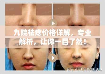 九院祛痣价格详解,专业解析,让你一目了然!